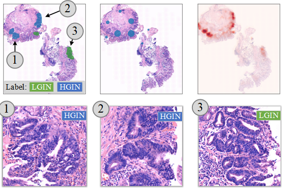 Histopathology image analysis