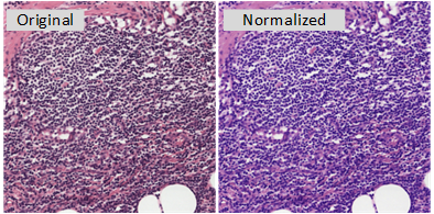 Histopathology color normalization